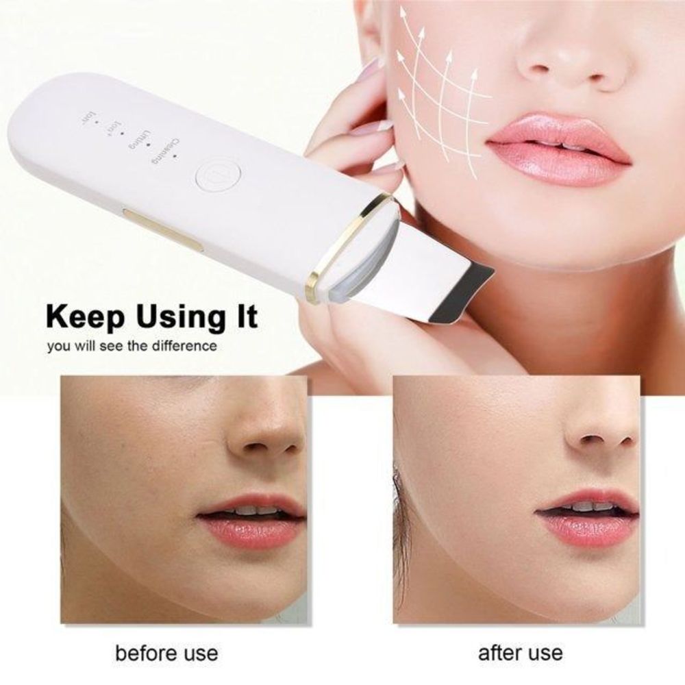 Facial Deep Cleansing Blackhead Removal Skin Scrubber Skin Pore Clean Gold - Picture 4 of 5